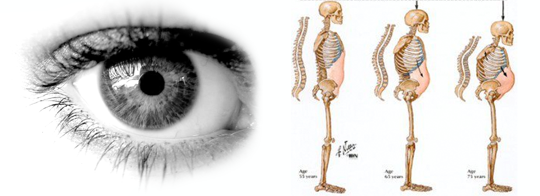 Bone and Eye